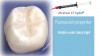 The Advantage of UltraSeal XT Plus and Hydro Sealants